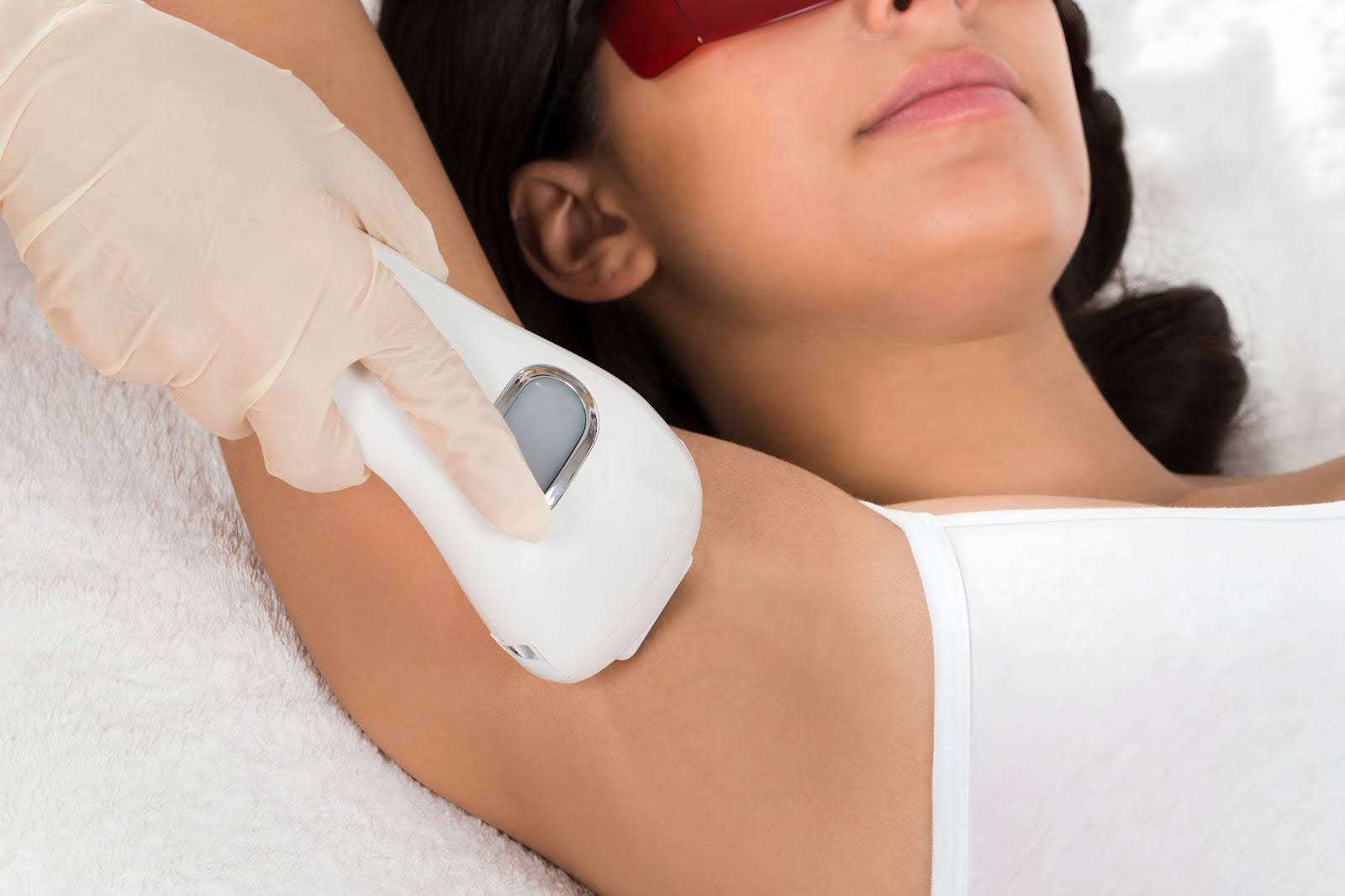 laser hair removal sessions