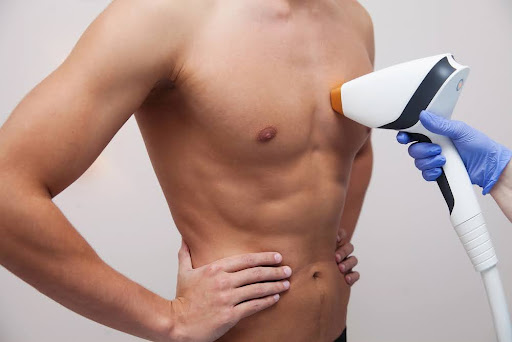 how laser hair removal works